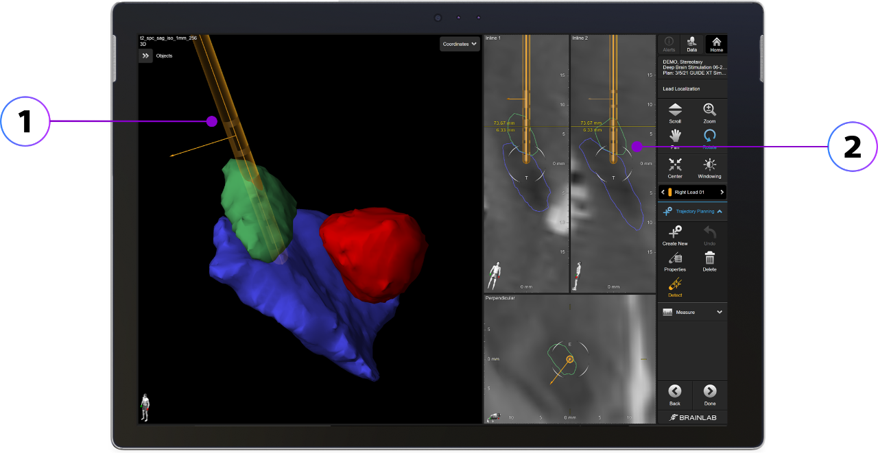 Tablet with Vercise Neural Navigator 5 Software showing a split screen of deep brain stimulation lead orientation and programming options.