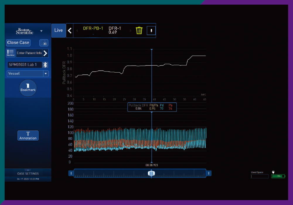 PhysioMap™