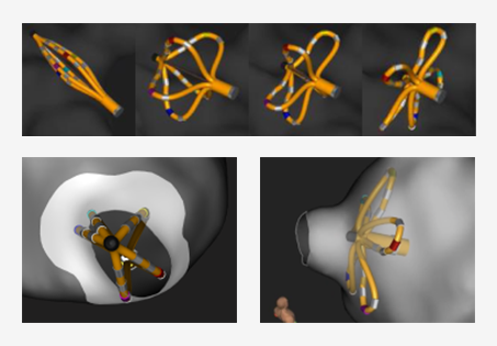 multiple catheter images