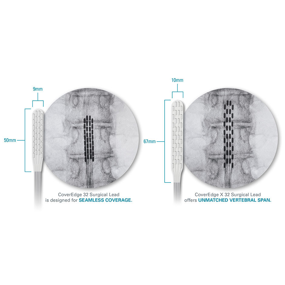 abbott spinal cord stimulator lead neck location