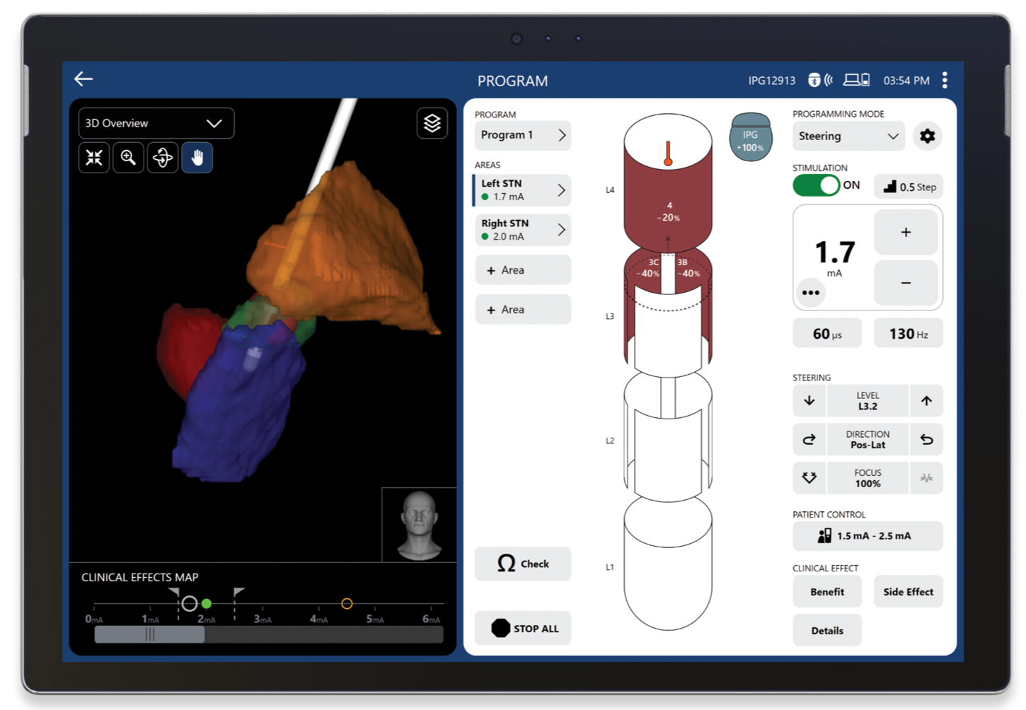 Bildgestützte Programmierung mit Stimview XT™