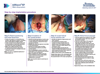 AdVance™ XP Step-by-Step Brochure 