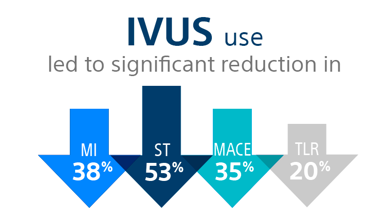 IVUS reduction