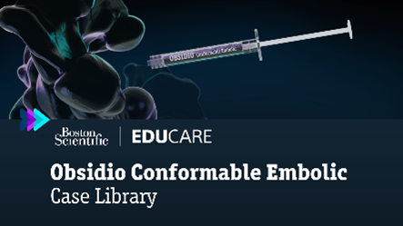 Preview of the Obsidio Conformable Embolic case library.