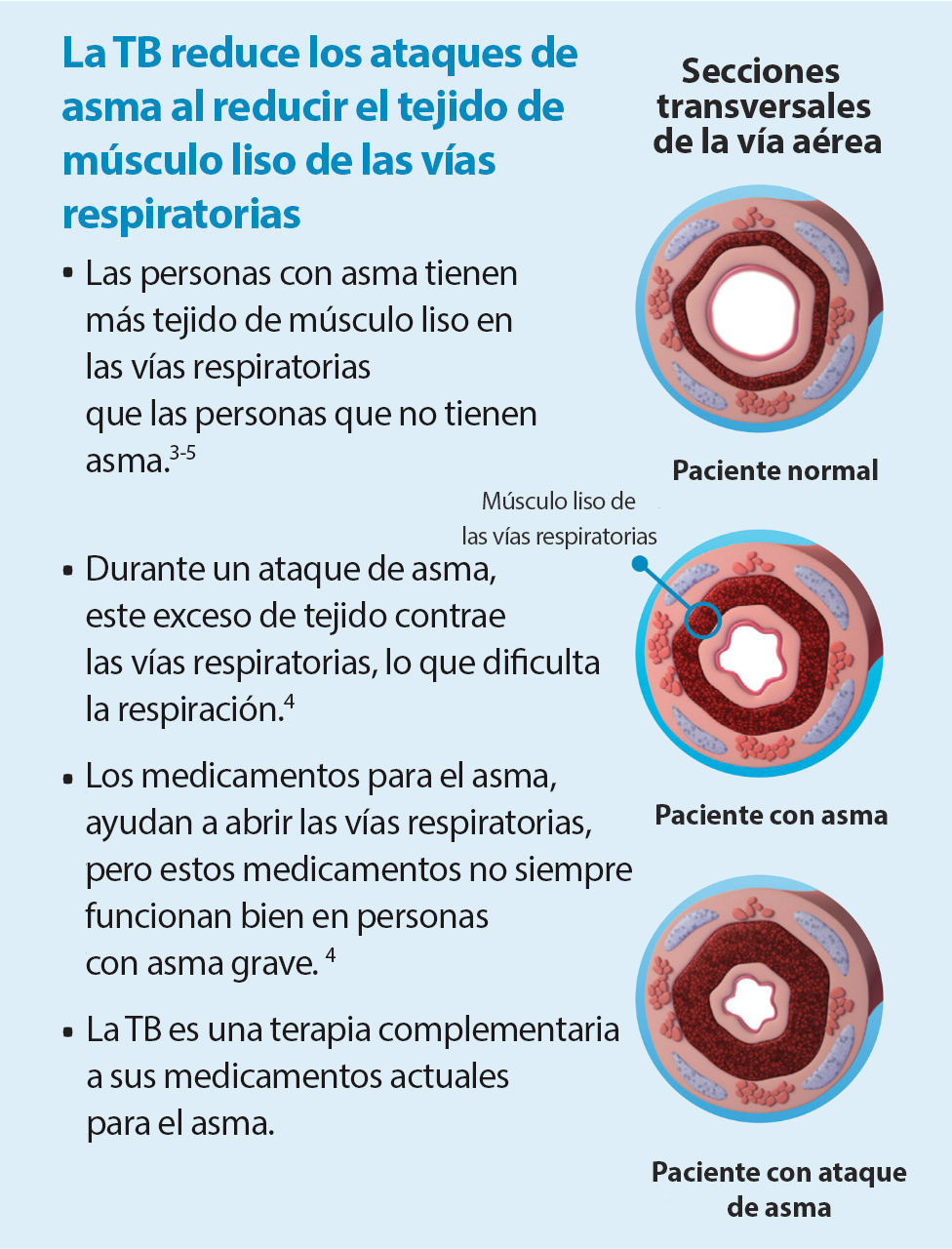 Qué sucede durante un ataque de asma