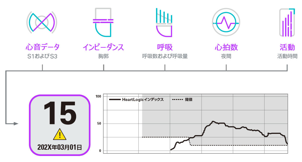 ICDシステム「RESONATE™ ICDシリーズ」について心不全症状を反映する複数の生体情報センサHEARTLOGIC™の承認を取得